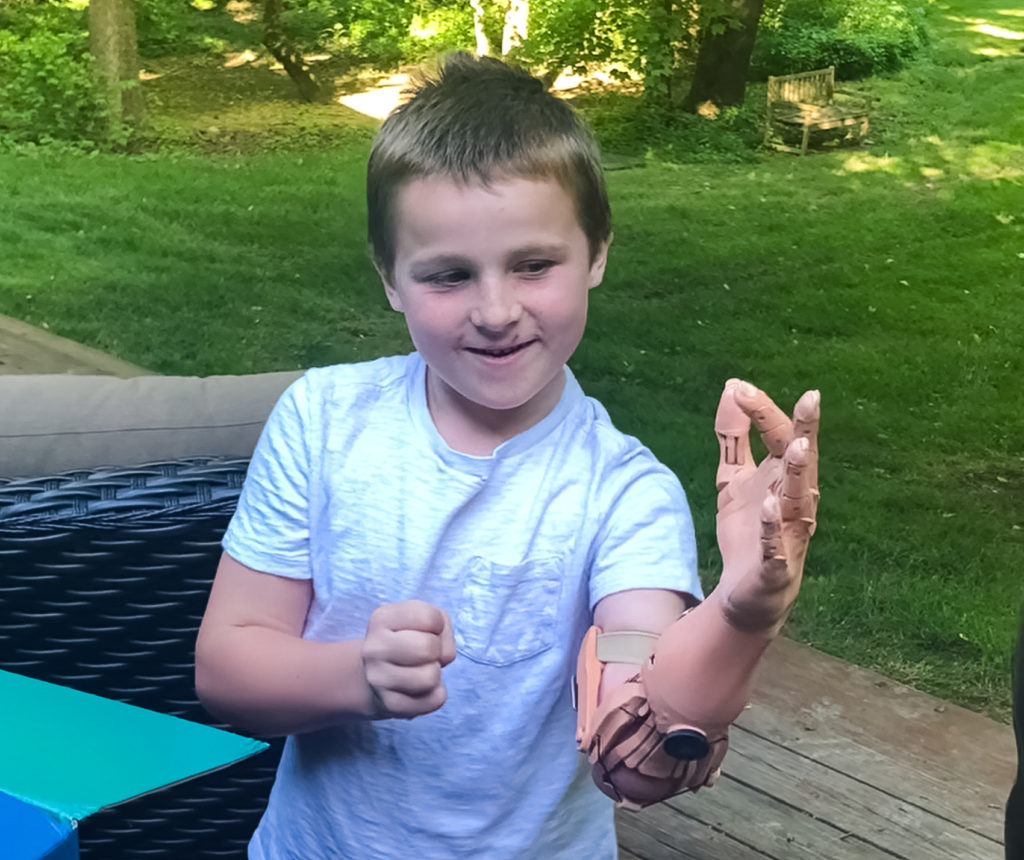TrueLimb User Story - Connor