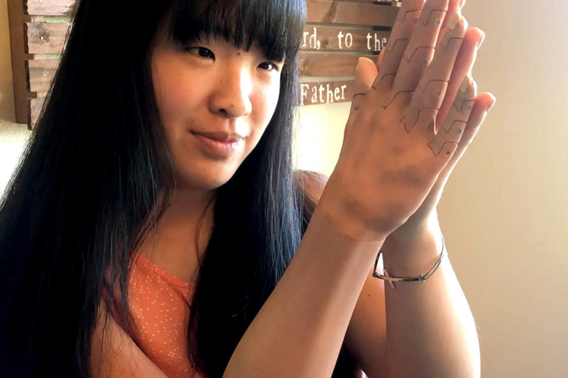 Charis 2 – for web – cropped A bionic arm user.