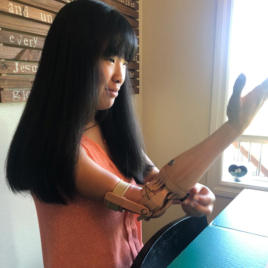 TrueLimb User Story - Charis