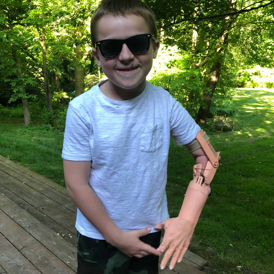 TrueLimb User Story - Connor