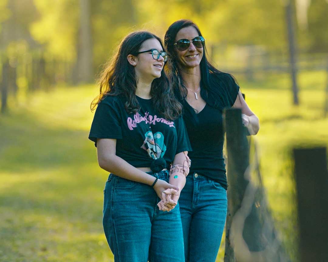 Insurance for prosthetic arms can be difficult for families