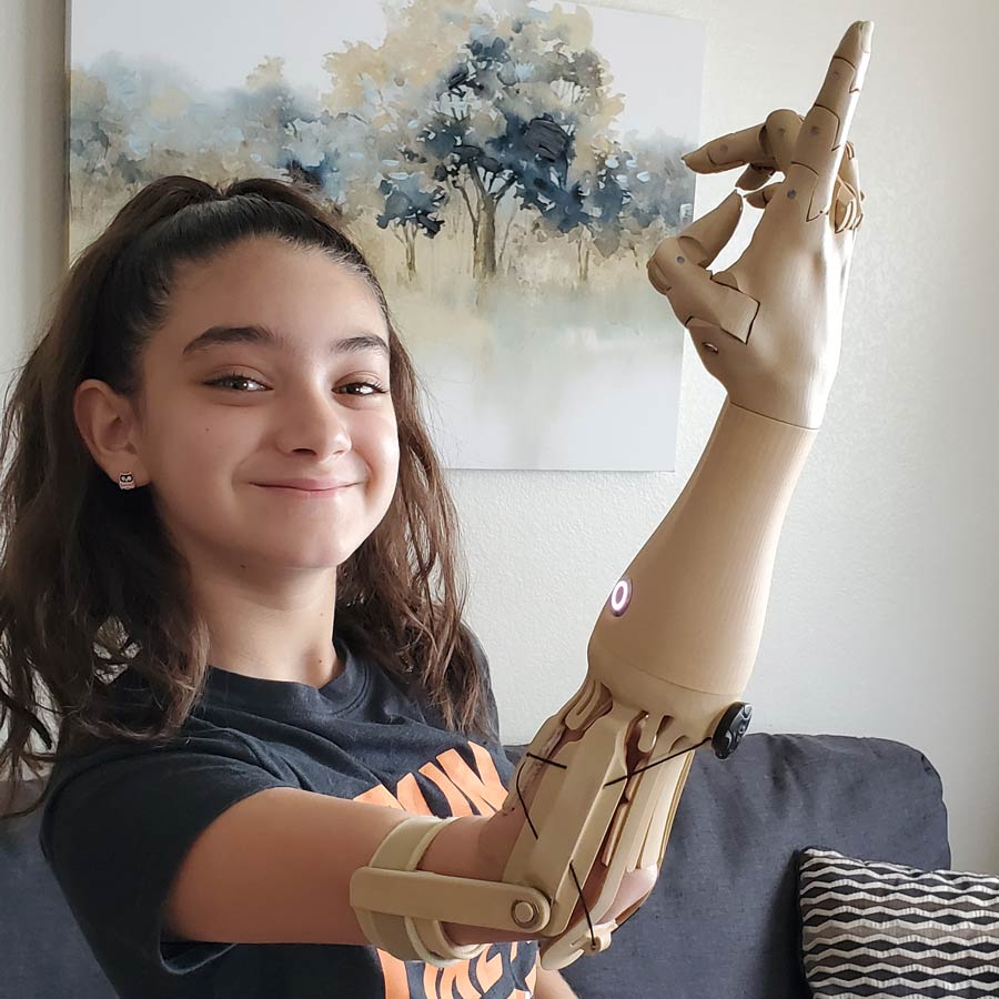 TrueLimb User Story - Natasha