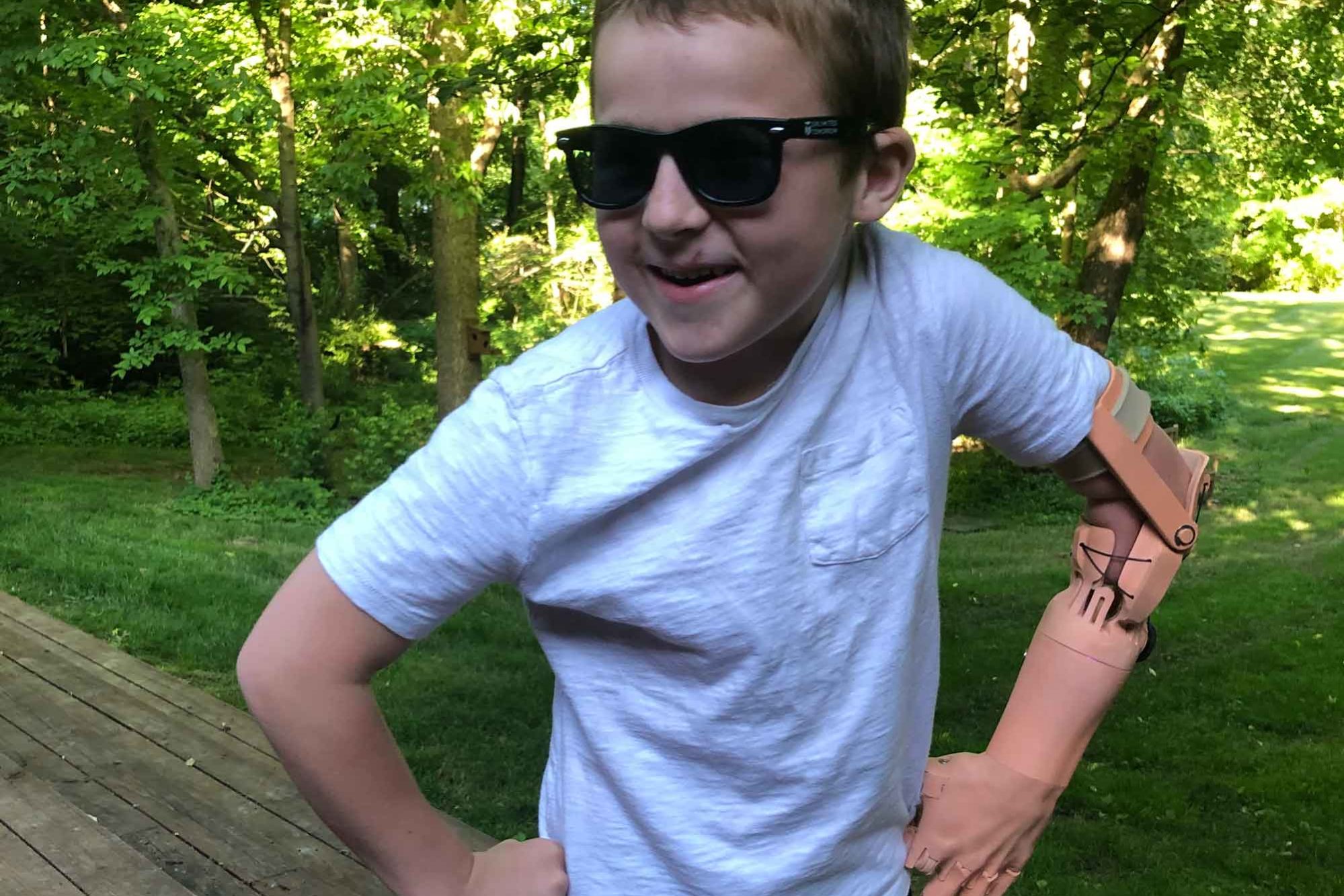 Tyler-Christman—41BEBBF5-10D1-4E01-A891-3EF8BFC07A12 TrueLimb is made to expand access to prosthetics for children.